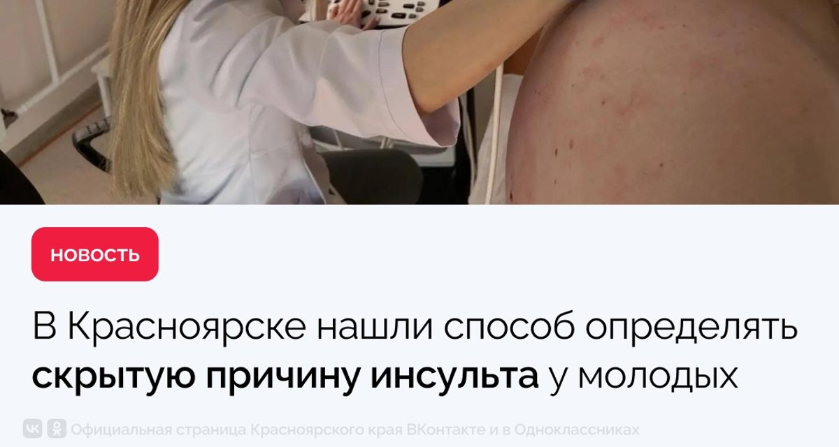 В Красноярске УЗИ с пузырьками выявило сердечный дефект у пациентов младше 55 лет после инсульта